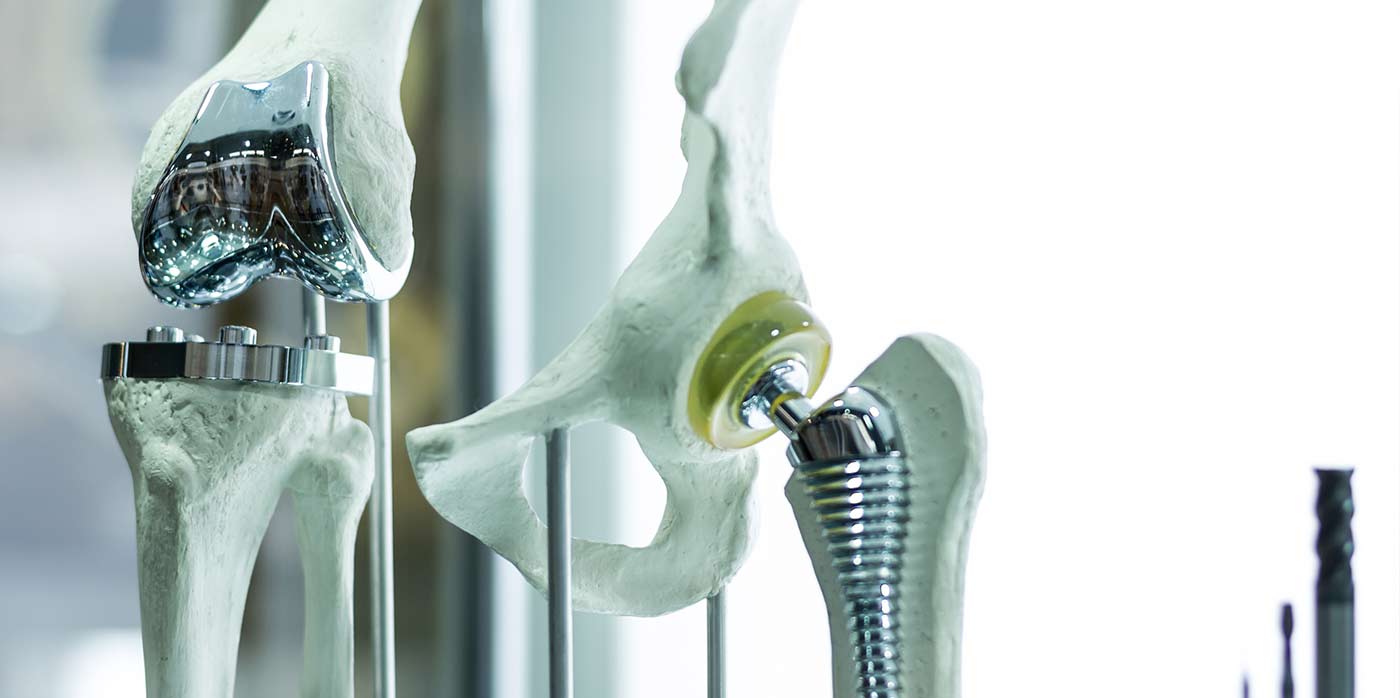 Hip Replacement
